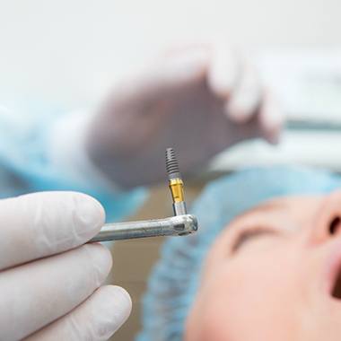 dentist holding a dental implant with the patient in the background 