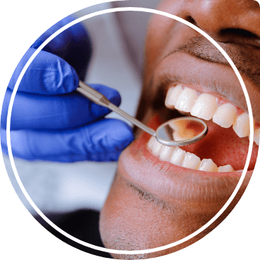 Close up of man with dental mirror in his mouth