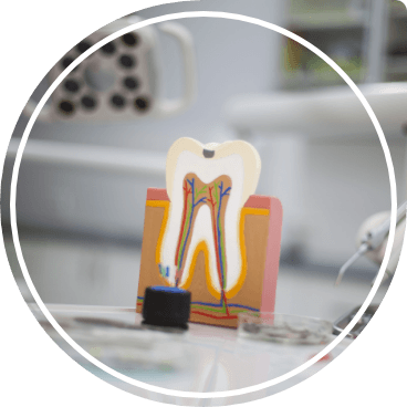 Model of tooth showing locations of nerves inside of it