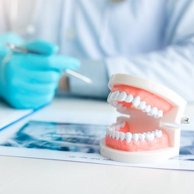 Model of denture on dentist's desk next to X-ray and paperwork