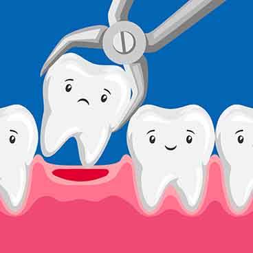Cartoon teeth smiling around a frowning one being removed with forceps