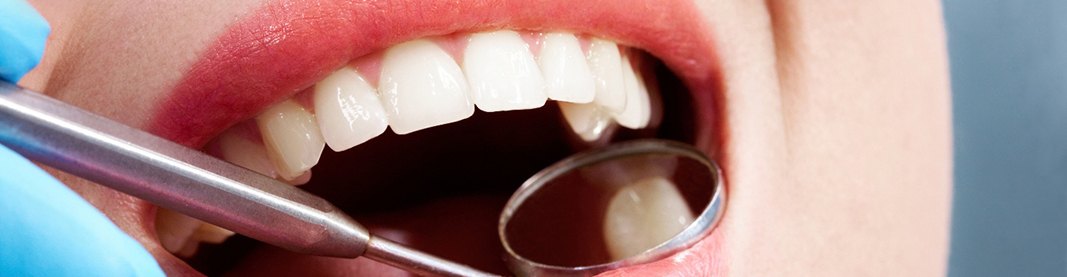 Closeup of woman&rsquo;s tooth reflected in dental mirror