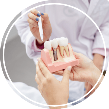 Dentist showing a model of a dental implant to a patient