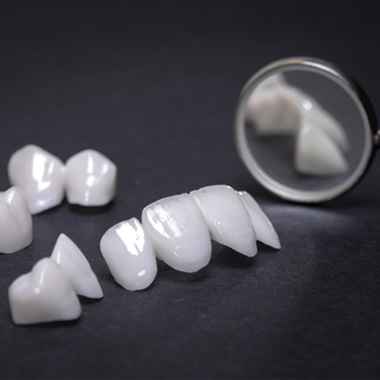 Veneers are thin porcelain shells that instantly transform the appearance of your teeth