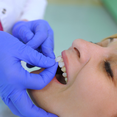 The process of getting veneers begins with a consultation at Unique Dental of Winchendon